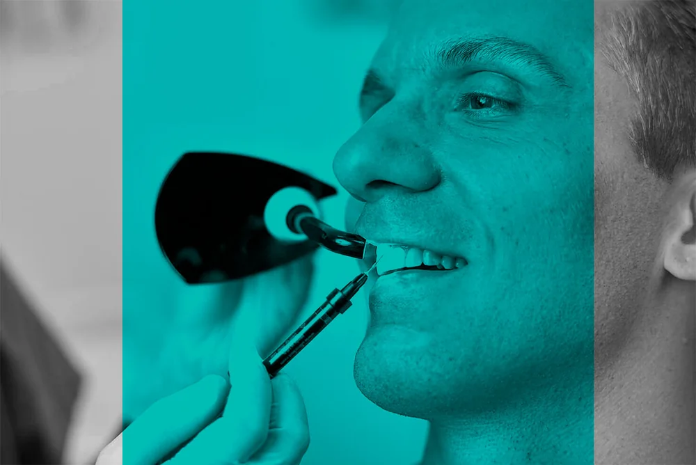 Mann erhält von Zahnarzt in Augsburg eine Bleaching-Behandlung